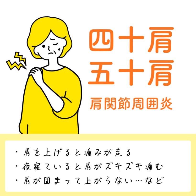 四十肩・五十肩（肩関節周囲炎）
